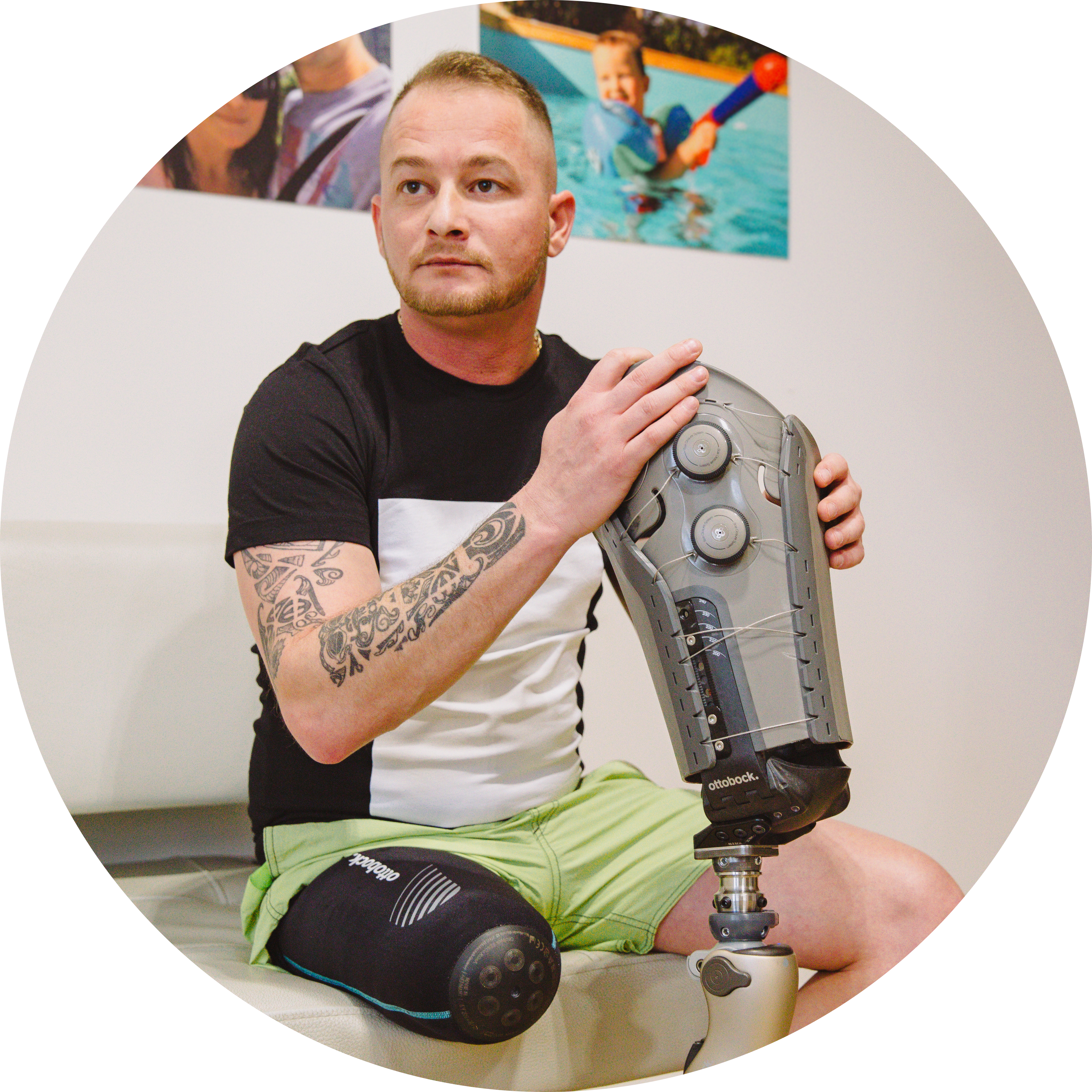 Varos Prosthetic Socket